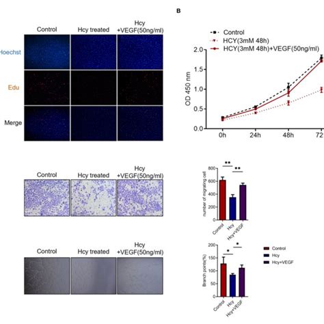 Homocysteine Hcy Inhibits The HBMECs Proliferation Migration And