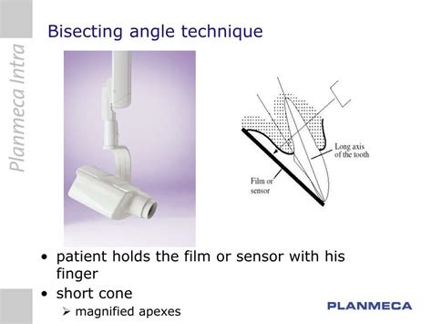 PPT - Bisecting angle technique PowerPoint Presentation, free download ...