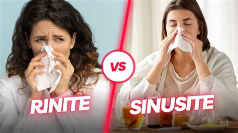 DIFERENÇAS ENTRE RINITE E SINUSITE Tudo o Que Você Precisa Saber