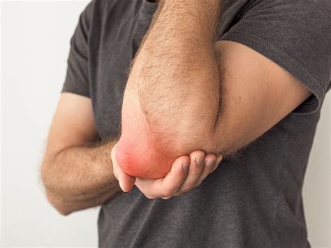 Elbow Bursitis Specialist Palm Harbor Fl Orthopedic Specialists