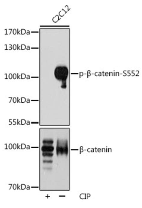 Anti Phospho Beta Catenin S552 Antibody Produced In Rabbit