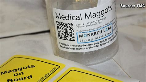 Could maggots help prevent surgery? It worked for this patient