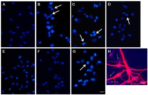 Hoechst 33342 Staining Of Apoptotic Striatal Neurons The Effects Of