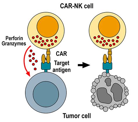 NK细胞是什么 CAR NK细胞疗法 全球肿瘤医生网