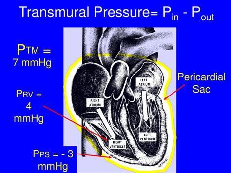 PPT - Arterial Pressure PowerPoint Presentation, free download - ID:6358620