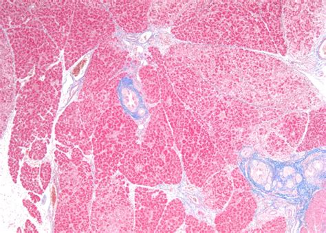 Pancreas: Exocrine and Endocrine – Veterinary Histology