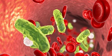 Sepsis Symptoms Treatments And Causes What Is Sepsis