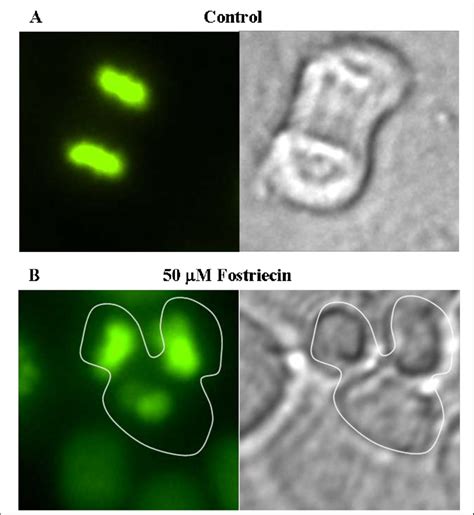 enlarged images highlight abnormalities  chromosome segregation