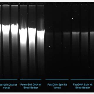 Agarose gel showing the effect of the four different combinations of ...