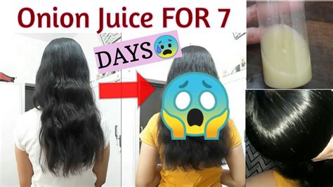 I Used Onion Juice On Hair For 7 Days 😱 Shocking Results Extremely