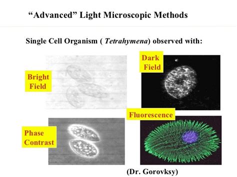 Phase contrast microscopy