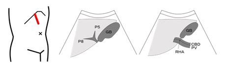 Japanese Society Of Sonographers