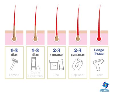 Como Funciona Tudo Sobre A Depila O A Laser Para