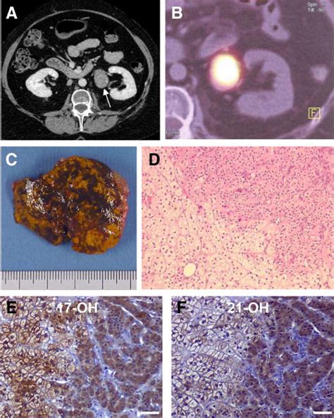 Radiological Scintigraphic And Histological Presentations Of The