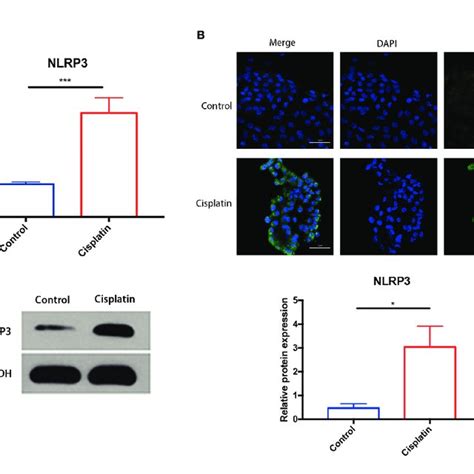 The Expression Differences Of Nlrp Asc Caspase And Gsdmd In The