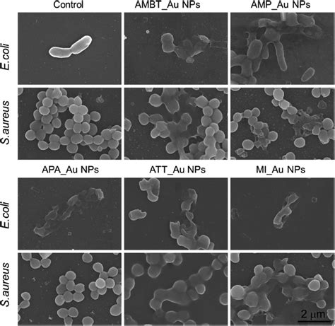 Morphology Of E Coli And S Aureus With And Without N Au Np Treatment