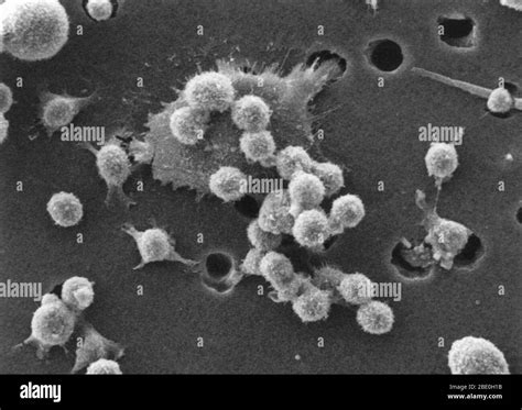 Macrophage Engulfing Bacteria Sem