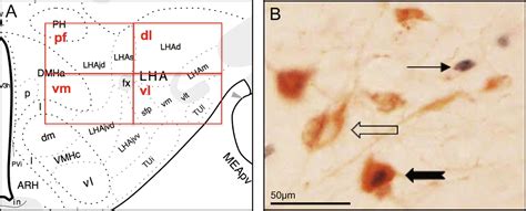 Hedonic Eating Sex Differences And Characterization Of Orexin