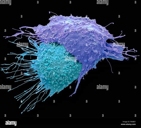 Ovarian Cancer Cells Coloured Scanning Electron Micrograph Sem Of