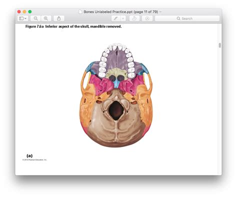 Cranial Bones And Landmarks Diagram Quizlet