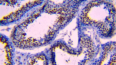 Nut Antibody Diagnostic Biosystems Dbs