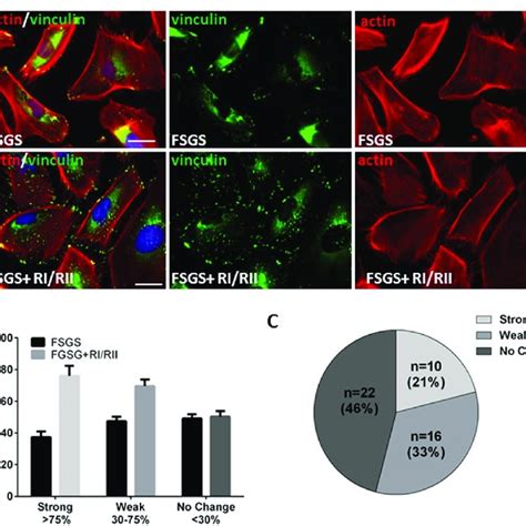 Inhibition Of Serum Podocyte Toxicity By Blockade Of Tnfα Signaling Download Scientific