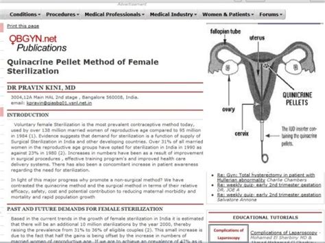 Essure (2)