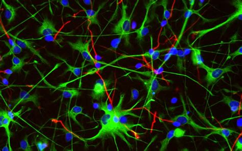 Adult Neural Progenitor Cells Kosheeka Kosheeka