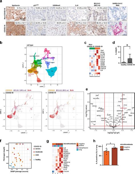 Vignettes Of Vis In Human Covid Lung Specimens A Iha Of Senescence