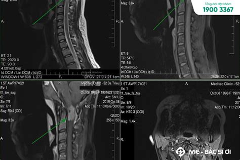 Bảng Giá Chụp Mri Cột Sống Tại 8 Bệnh Viện Phòng Khám