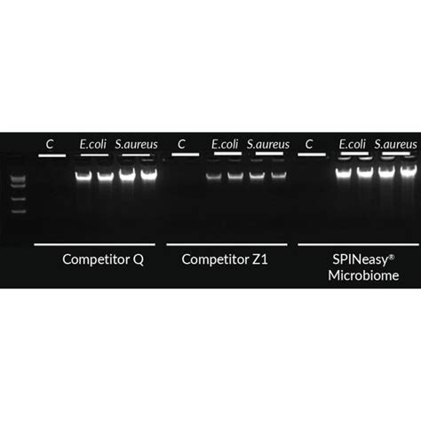 Mp Biomedicals Spineasy Dna Kit For Microbiome Isolation Technology