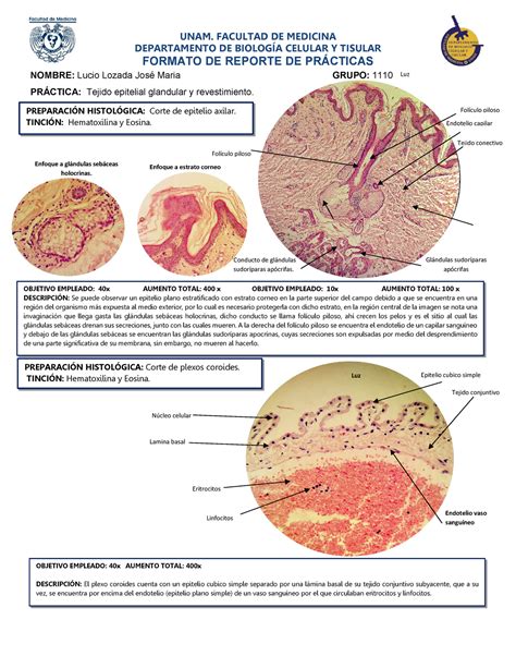 Cortes Histol Gicos De Axila Y Coroides Unam Facultad De Medicina