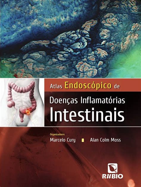 Atlas Endoscópico De Doenças Inflamatórias Intestinais Clinica Scope