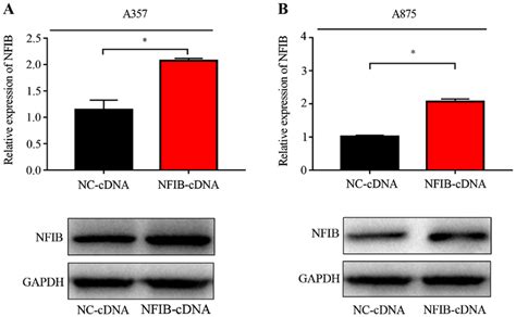 Detection Of Nfib Overexpression Efficiency In Melanoma Cells Reverse Download Scientific