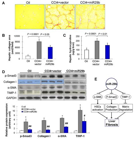 Gene Transfer Of Mir 29b Prevents Ccl4 Induced Liver Fibrosis In Mice