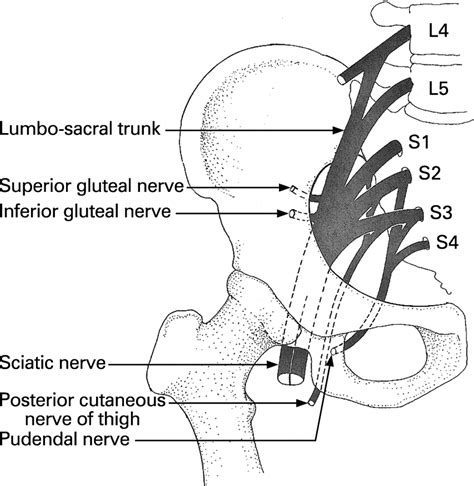 Foot Drop Where Why And What To Do Practical Neurology