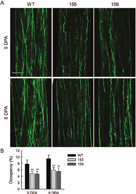 F Actin Organization In The Wild Type And GhCFE1A Overexpressing Fibre