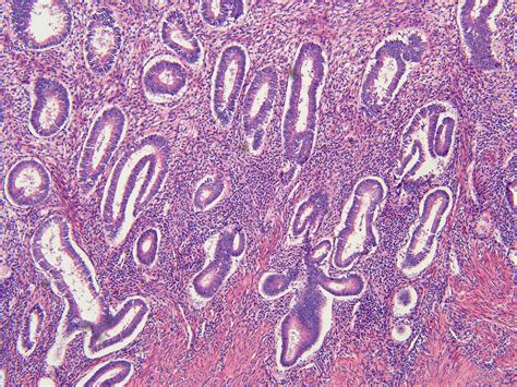 Uterus In Late Proliferative Phase 100 X Anatomicum