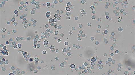 Yeast Cell Microscope