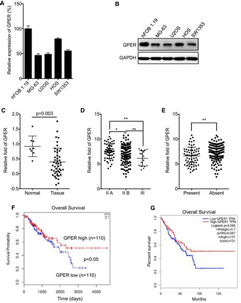 The Expression Of GPER In OS Cells And Tissues The MRNA A And