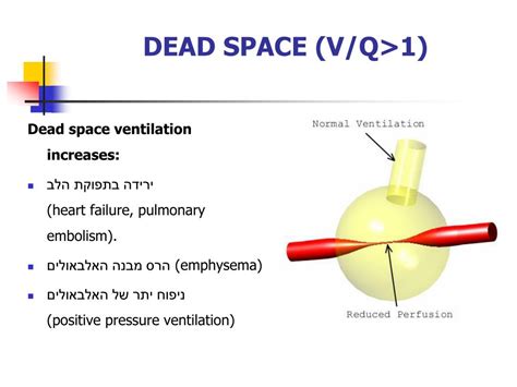 Physiologic dead space ventilation perfusion - reqopmafia