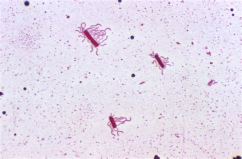 Biol Lab Manual Peritrichous Arrangement Of Flagella