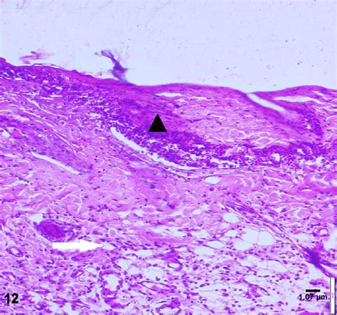 A photomicrograph of CD34 +cells treated group (19 days) showing... | Download Scientific Diagram