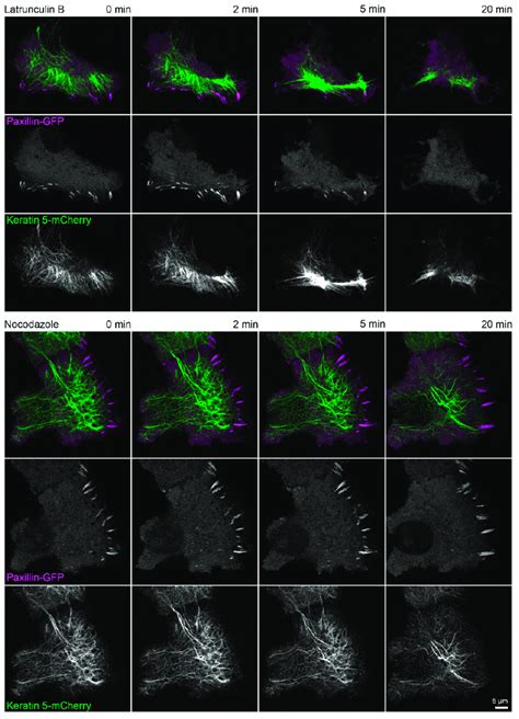figure  actin polymerization    focal adhesion