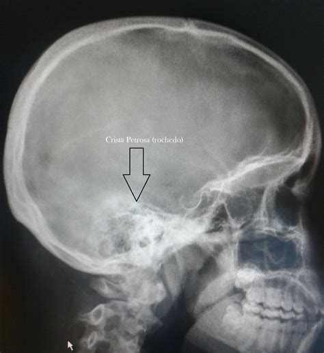 Dicas De Radiologia Tudo Sobre Radiologia Como Avaliar A Qualidade