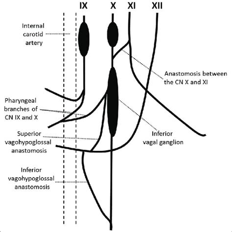 Pdf An Ansa Cervicalis With Vagohypoglossal Anastomosis Absent