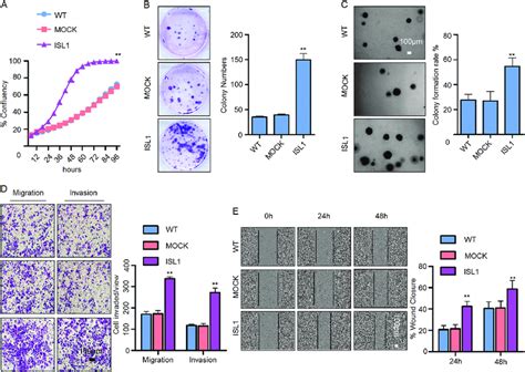 ISL1 Overexpression Promoted Cell Growth Migration And Invasion In