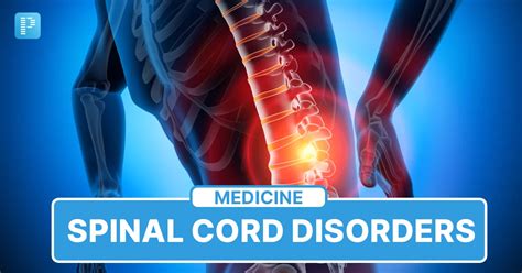 Spinal Cord Disorders