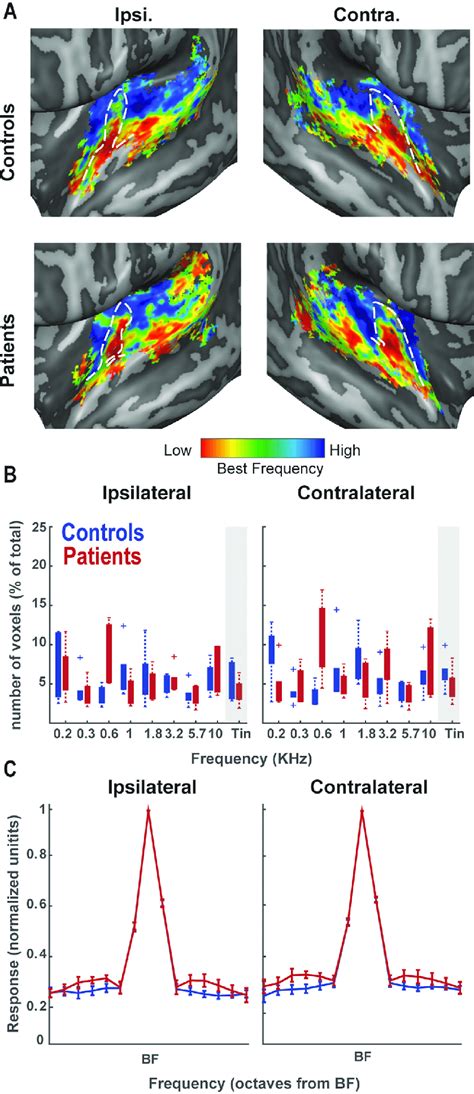 Tonotopy And Tuning Curves In The Auditory Cortex A Tonotopic Map In