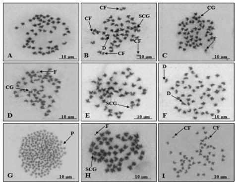 Different Types Of Chromosomal Aberrations In The Metaphase Spread Of